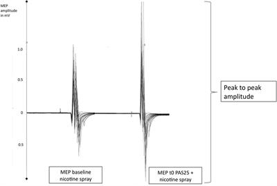 Nicotinic Restoration of Excitatory Neuroplasticity Is Linked to Improved Implicit Motor Learning Skills in Deprived Smokers